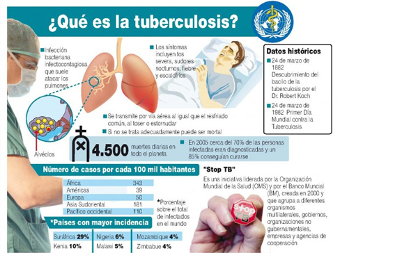 Tuberculosis Monterrey
